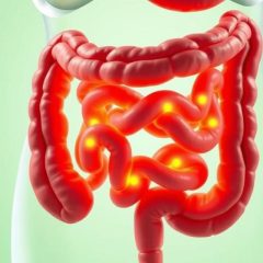 Problemy jelitowe: przyczyny, objawy i metody leczenia